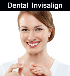 Dental Invisalign in Parramatta dental
