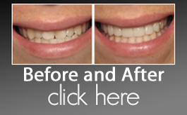 cosmetic dentistry before and after