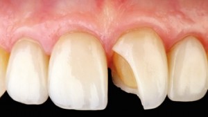 cosmetic-dentistry