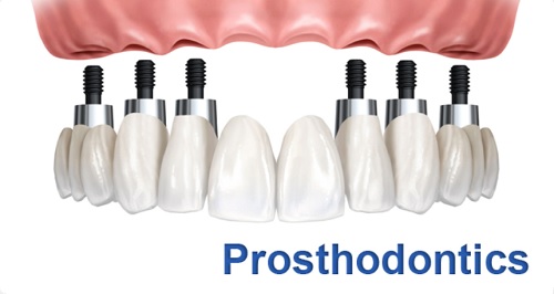 dental-implants-specialists